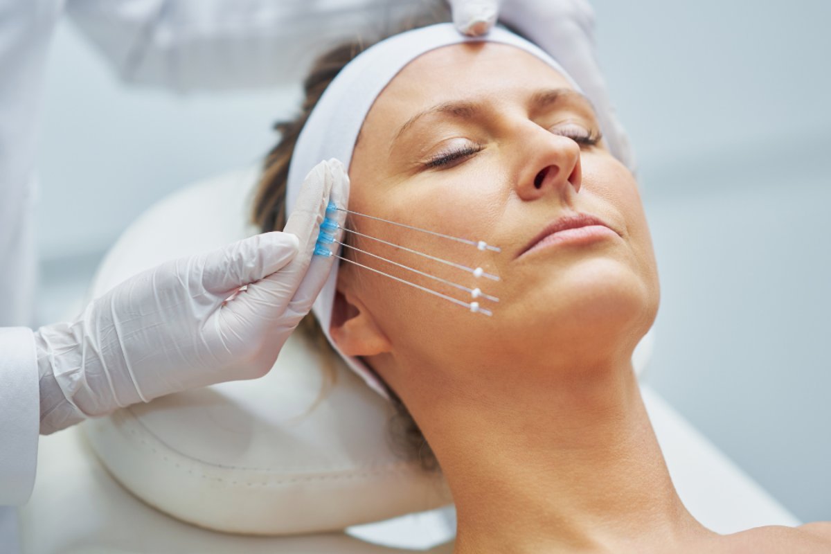 عوارض جانبی احتمالی لیفت با نخ کاگ