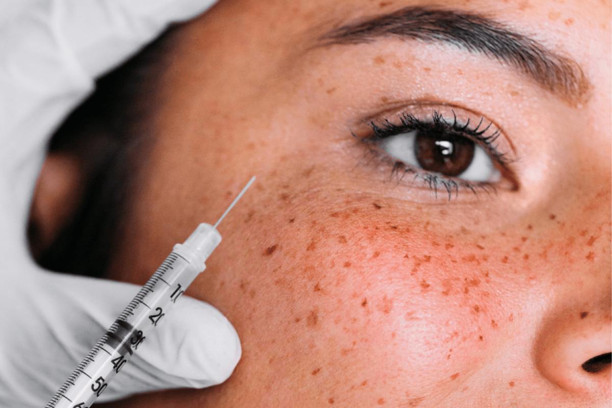 تزریق PRF صورت و مو چیست؟