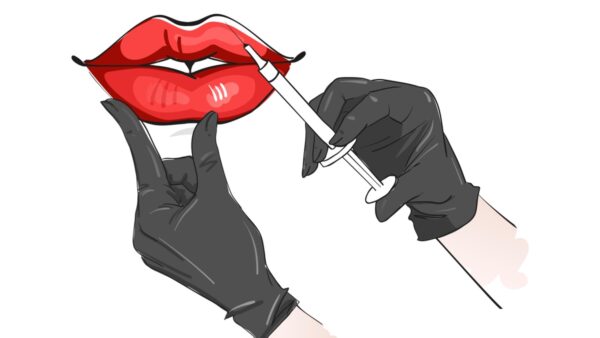 تزریق ژل بعد از شیدینگ لب